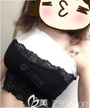 敏感自卑的你做一次娜綺麗假體隆胸后才發(fā)現女人挺起來更自信