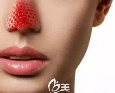 鼻子毛孔粗大怎么辦 鼻子毛孔粗大怎么辦