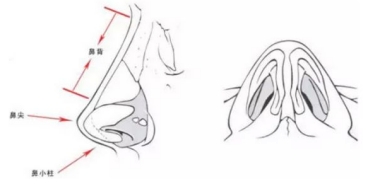 假體隆鼻對(duì)比圖片 假體隆鼻對(duì)比圖片