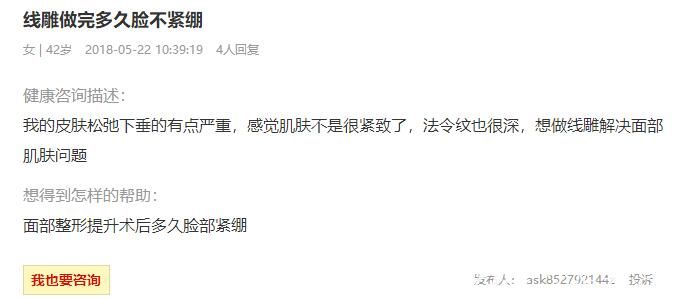 做完線雕多久臉沒有緊繃感的介紹