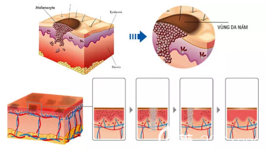 白瓷娃娃的作用原理