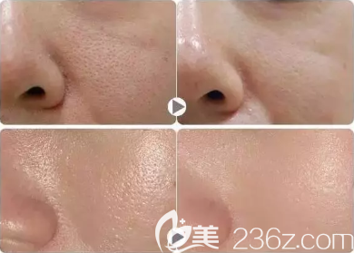 黑臉娃娃效果好不好