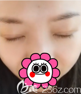 北京圣嘉新眼綜合案例