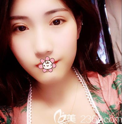 珠海新顏蘇錦和雙眼皮15天<span style= 珠海新顏蘇錦和雙眼皮15天<span style=