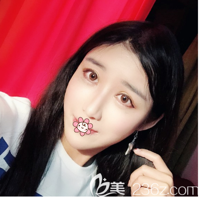 佛山華美祛眼袋效果怎么樣 佛山華美祛眼袋效果怎么樣