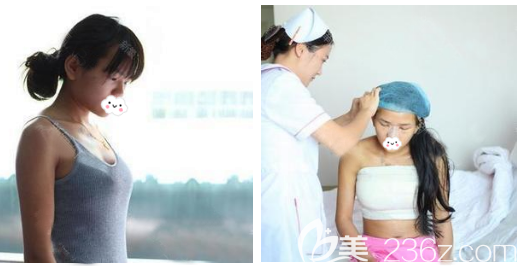 在東莞美立方做玉兔動(dòng)感隆胸術(shù)前照片 在東莞美立方做玉兔動(dòng)感隆胸術(shù)前照片