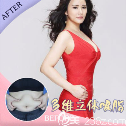 重慶美萊能做吸脂嗎 重慶美萊能做吸脂嗎