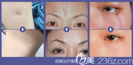 重慶美萊祛疤好的醫(yī)生是哪個(gè) 重慶美萊祛疤好的醫(yī)生是哪個(gè)