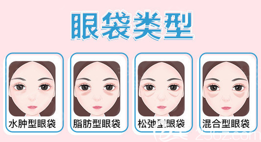 不同類型的眼袋 不同類型的眼袋