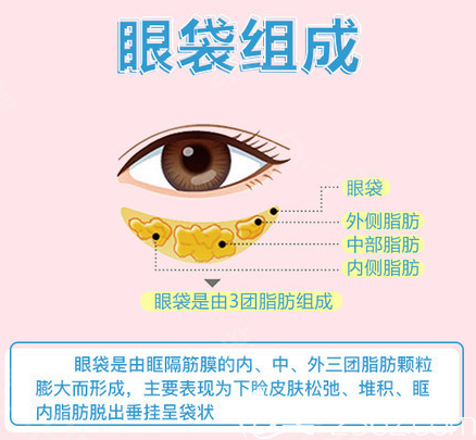眼袋的組成部位 眼袋的組成部位