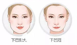 下巴寬大短 下巴寬大短