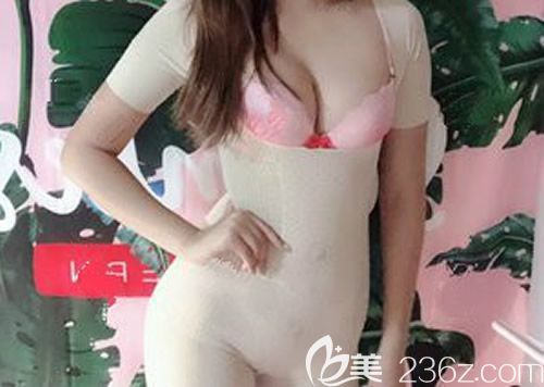 西寧時光整形王雙余給我做曼托260cc水滴形假體隆胸術后第42天