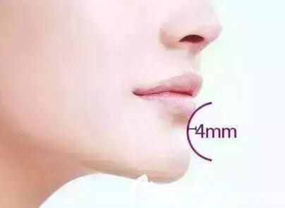 下巴在面部輪廓比例中占據(jù)重要的位置