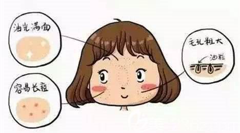討厭的油痘肌該怎么避免長(zhǎng)痘呢