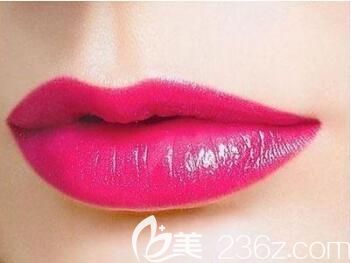 自體脂肪豐唇有后遺癥嗎？