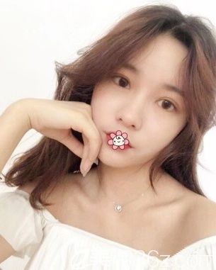 重慶美萊雙眼皮加祛眼袋開眼角 重慶美萊雙眼皮加祛眼袋開眼角