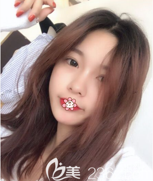 重慶美萊蘭宇做雙眼皮好不好 重慶美萊蘭宇做雙眼皮好不好