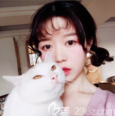 廣州廣大整形醫(yī)院隆鼻一個(gè)月<span style=