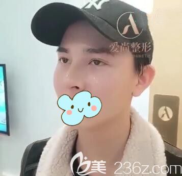 洛陽愛尚隆鼻后35天