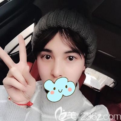 男士隆鼻效果圖來(lái)了 上傳我在洛陽(yáng)找李冉醫(yī)生做的耳軟骨隆鼻過(guò)程圖