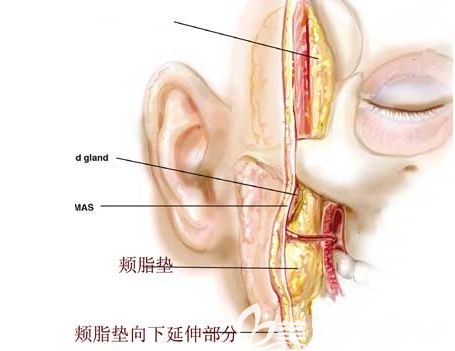 頰脂墊在面部所在部位的結(jié)構(gòu)示意圖