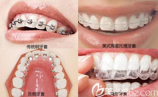 北京維嘉口腔張余新醫(yī)生擅長(zhǎng)項(xiàng)目