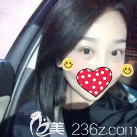得知沈陽名流美容醫(yī)院不僅口碑好而且做雙眼皮價格也很親民后我就做了雙眼皮修復術！