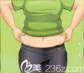 腰腹部贅肉多做腰腹吸脂后多久能消腫啊？
