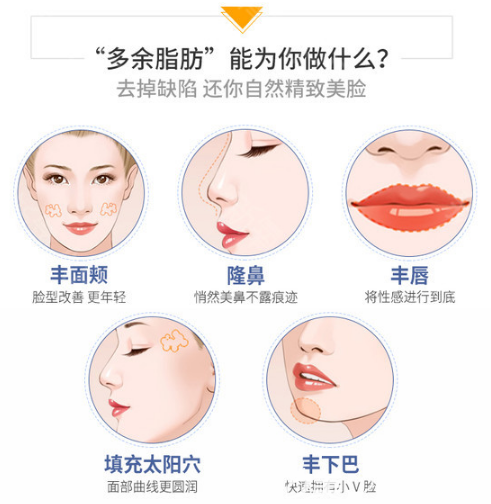 整形醫(yī)院自體脂肪填充適用范圍