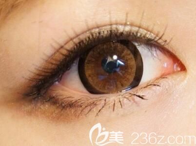 越來越多的人都選擇做全切雙眼皮