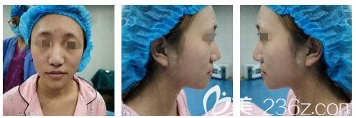 面診南京韓辰醫(yī)生鼻子問(wèn)題明顯 面診南京韓辰醫(yī)生鼻子問(wèn)題明顯