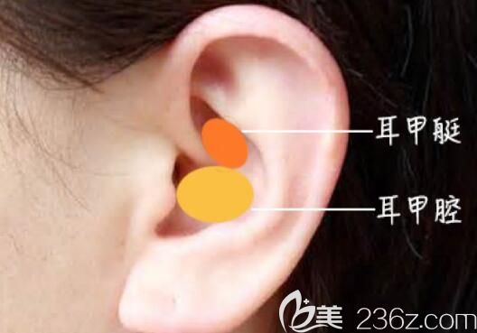 切取耳軟骨的位置選擇 切取耳軟骨的位置選擇