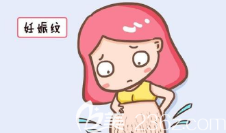 長(zhǎng)妊娠紋的圖片