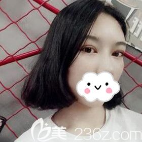 在懷化割雙眼皮術(shù)后1個月時的恢復(fù)<span style=