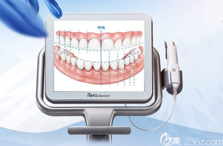 優(yōu)貝口腔iTero口掃