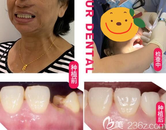 真人案例效果來(lái)驗(yàn)證下美奧口腔好不好