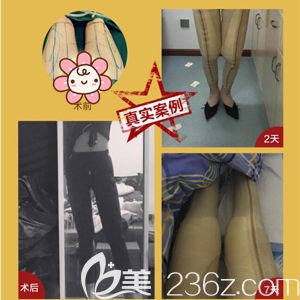 20190906_1567765951896676.jpg 吸脂.jpg