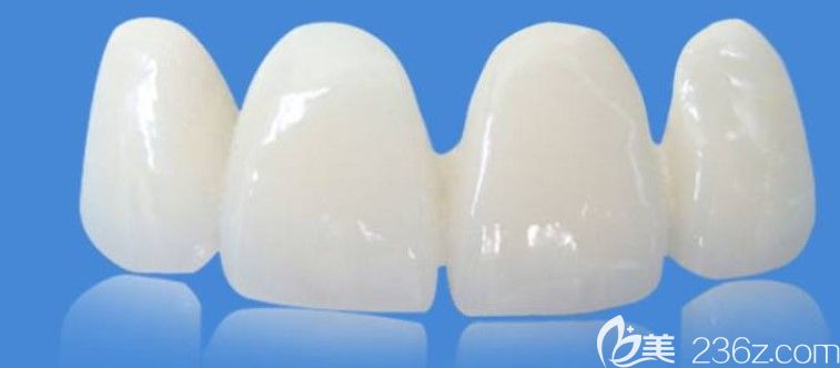 咼永洪醫(yī)生科普:牙貼面和美容冠有什么區(qū)別 咼永洪醫(yī)生科普:牙貼面和美容冠有什么區(qū)別