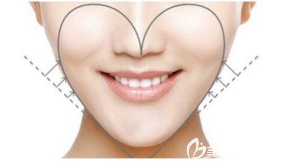 蘋果肌的準確位置介紹