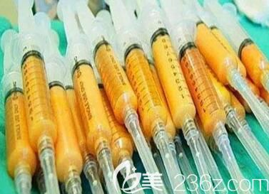 體脂肪填充面部到底可以維持多久？