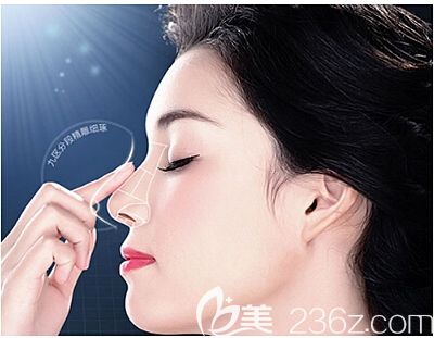 假體隆鼻可以改善鼻梁凹陷