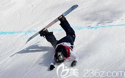 假體隆鼻術(shù)后要避免摔倒