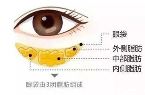 眼袋脂肪組成結(jié)構圖