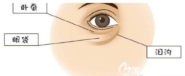 眼袋和淚溝的區(qū)別 眼袋和淚溝的區(qū)別