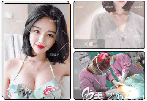 深圳富華唐新輝隆胸<span style= 深圳富華唐新輝隆胸<span style=