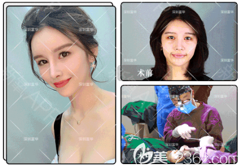 深圳富華唐新輝隆鼻<span style= 深圳富華唐新輝隆鼻<span style=