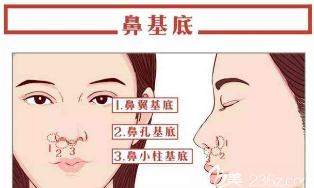 鼻基底凹陷部位示意圖