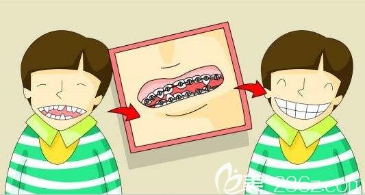 任茹冰醫(yī)師科普兒童牙齒矯正的方法