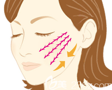 埋線提升多久洗臉可以恢復(fù)