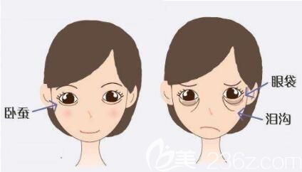 自體脂肪填充臥蠶能夠維持多久呢？